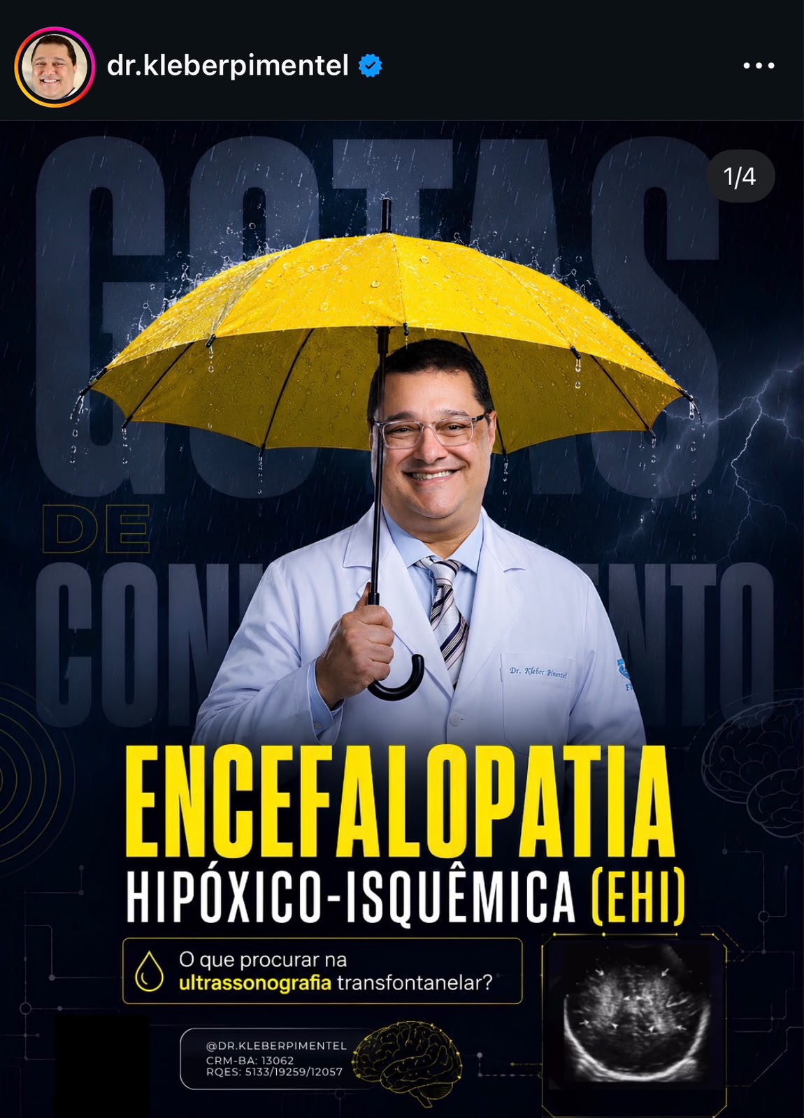 Post para o Dr. Kleber Pimentel: encefalopatia hipóxico-isquêmica
